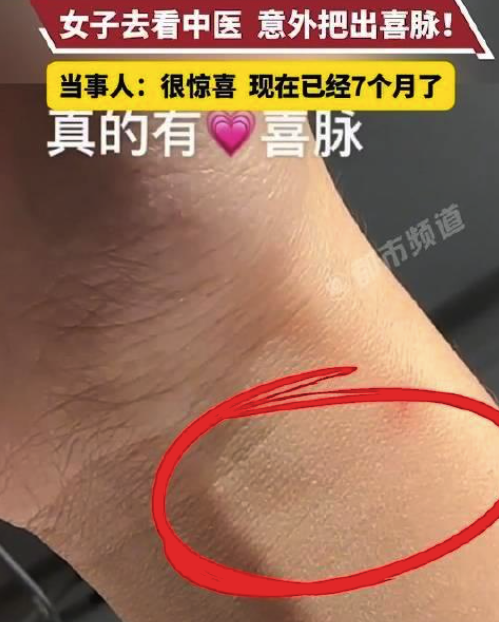 女子陪家东说念主看中医巧合把出喜脉 网友：第一次肉眼明晰看到喜脉！