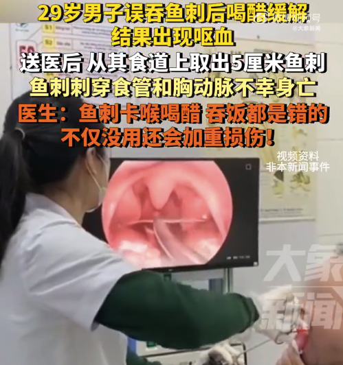 男子误吞鱼刺两天后不幸身亡 医生提醒鱼刺卡喉喝醋吞饭都不对