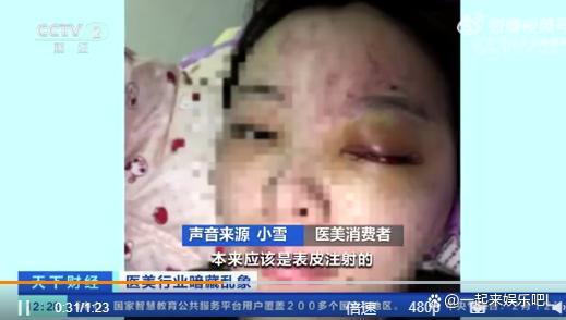 爱美90后女子注射6针玻尿酸致残 错误注射到血管里造成中央动脉堵塞