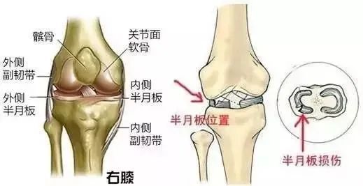 “16连蹲”火爆全网，医生提醒：不适合所有人模仿