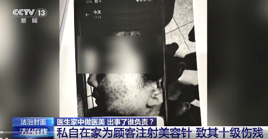 女子为图便宜在医生家里打水光针致残 医美诊所遭索赔
