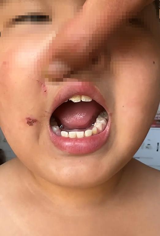 警方通报一教师虐待学生 男孩表示自己让老师不要打了但老师还是打