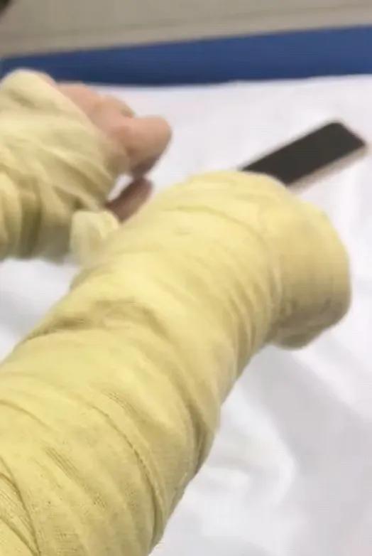 湖南一主播被伪装成快递的炸弹包裹炸伤,面部达深二度烧伤 疑因个人矛盾遭报复