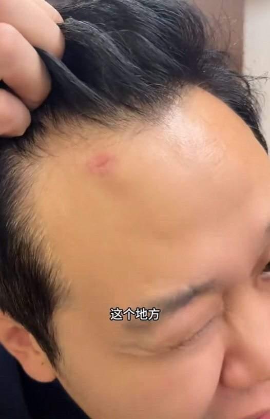 中国球迷墨西哥遭抢劫:被用枪抵头“人生第一次被枪顶着脑门!”