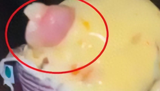  Online Ice Cream Eating Broken Fingers: A Scary Moment for Indian Doctors