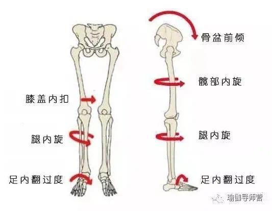 有一种小肚子叫骨盆前倾，几个简单动作可帮助调整