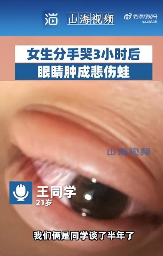 女生哭3小时成“悲伤蛙” 网友：简直就是青蛙本蛙