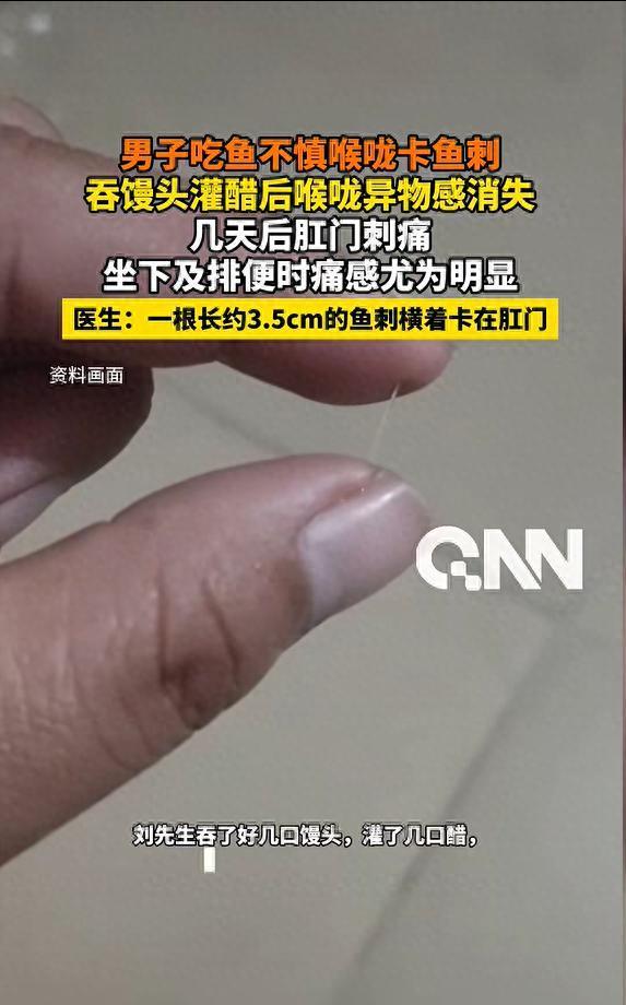男子鱼刺卡喉硬吞4天后扎进肛门