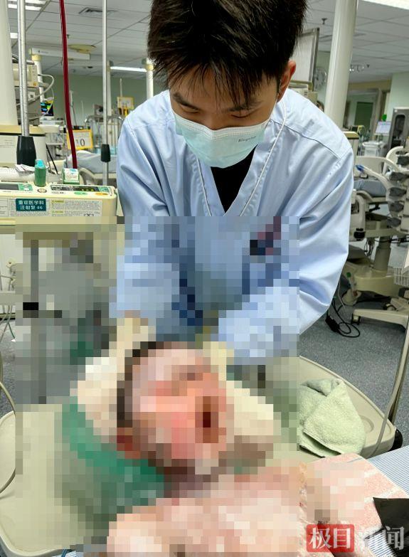 家长喂退热药后9岁男孩大面积溃烂 常见药物引发严重反应