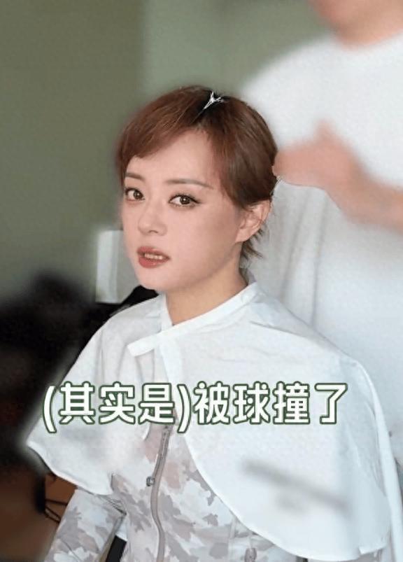 孙俪回应左眼受伤
