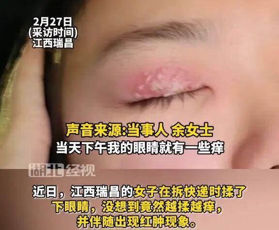 女子拆快递后不洗手揉眼睛致疱疹