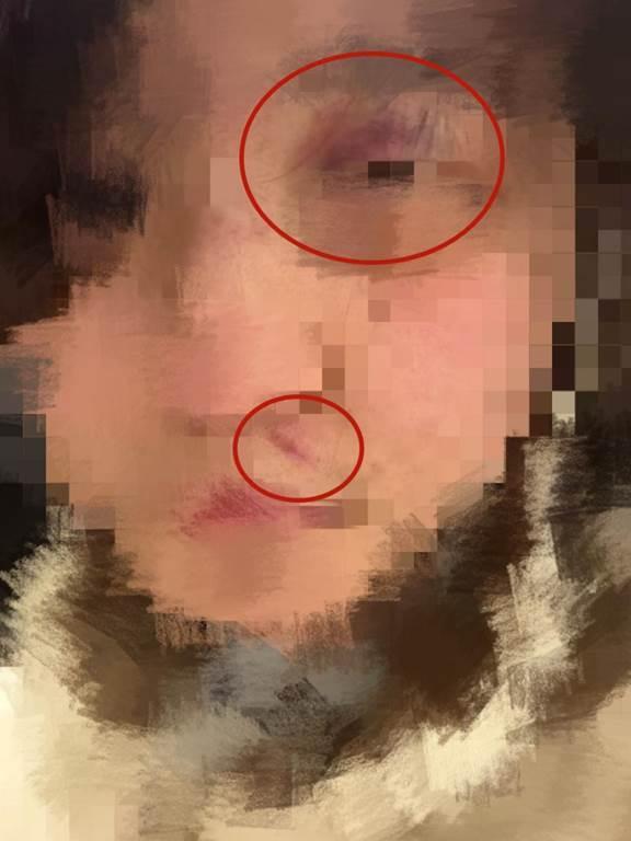 17岁女生称遭男友性侵殴打 最新进展