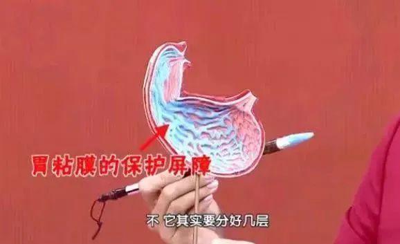 26岁女生因幽门螺旋杆菌确诊胃癌！