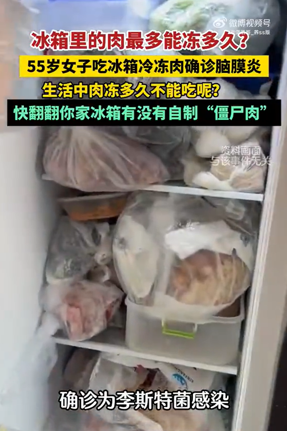 55歲女子吃冰箱冷凍肉確診腦膜炎