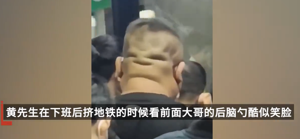 喜感！一男子后脑勺酷似笑脸，拍摄者误以为他反着排队