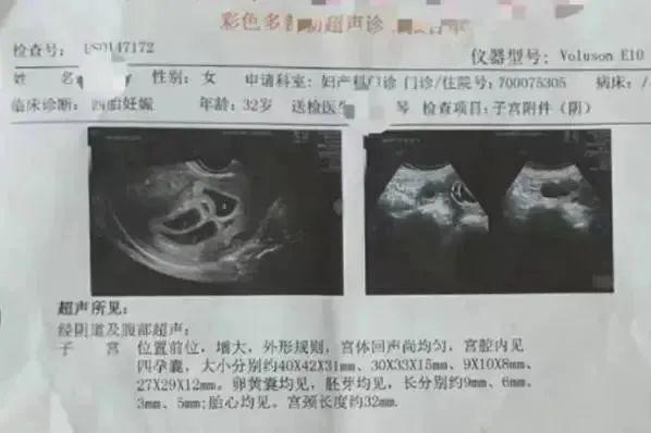 怀4胞胎女子终止妊娠，刚生完4胞胎9个多月又怀上4胞胎
