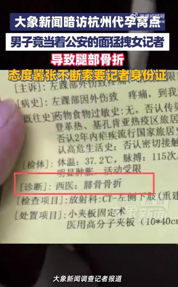 女记者暗访代孕窝点被打骨折 无资质实验室骗局揭秘