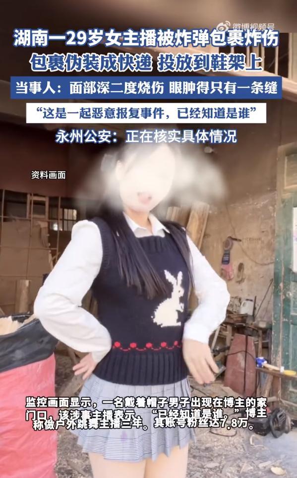 被炸伤女主播母亲发声 女儿面部严重烧伤