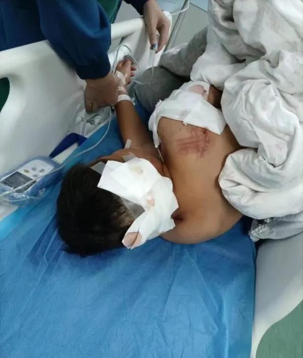 又一起！10岁男孩遭大型犬咬伤！母亲：孩子仍在ICU抢救