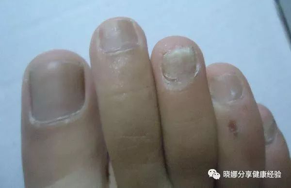 这6种病听起来很吓人但其实基本不用治胃炎骨质增生等等都可观察