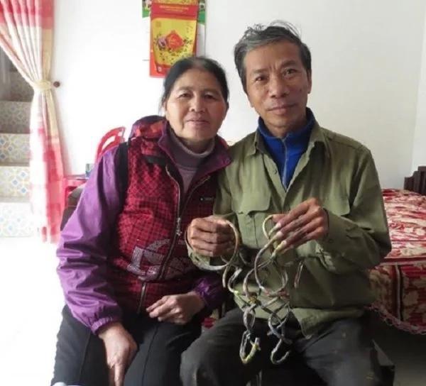 越南一名66岁男子33年没剪指甲 生活全靠妻子打理