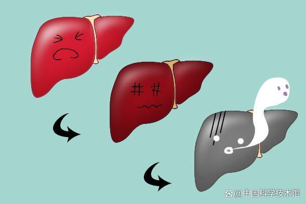 哪些日常习惯正在悄悄“喂养”肝癌 隐藏的风险因素