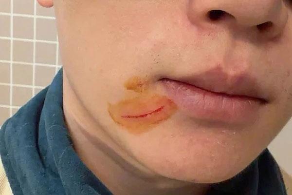 中国留学生在澳大利亚遭辱骂 种族歧视事件频发
