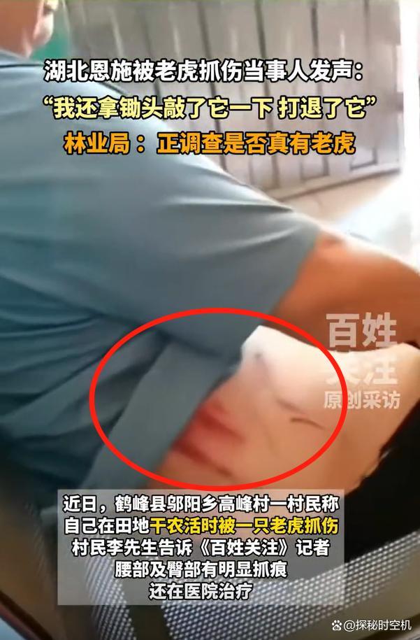 湖北村民称被老虎抓伤:打退了它 引发全网热议