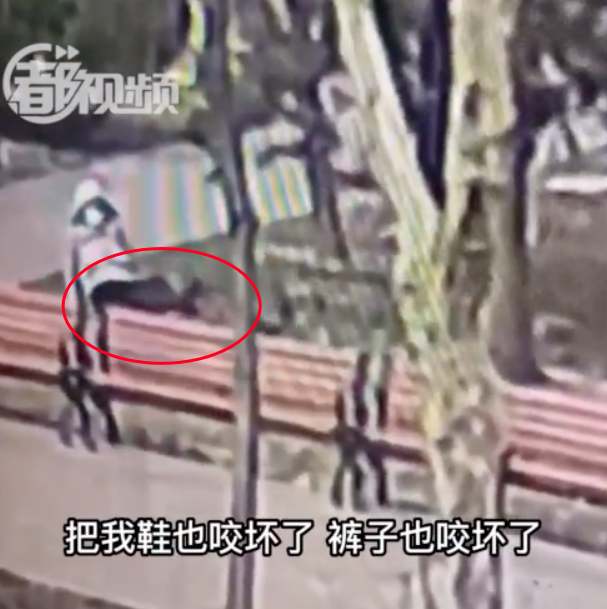 遛狗不栓绳路人腿上被咬出两道大狗牙印 犬主人的电话却一直无法接通！