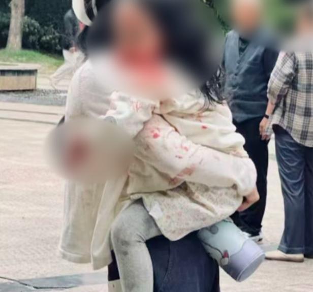 四川烈性犬咬伤女童狗主人被刑拘 事发时未牵绳