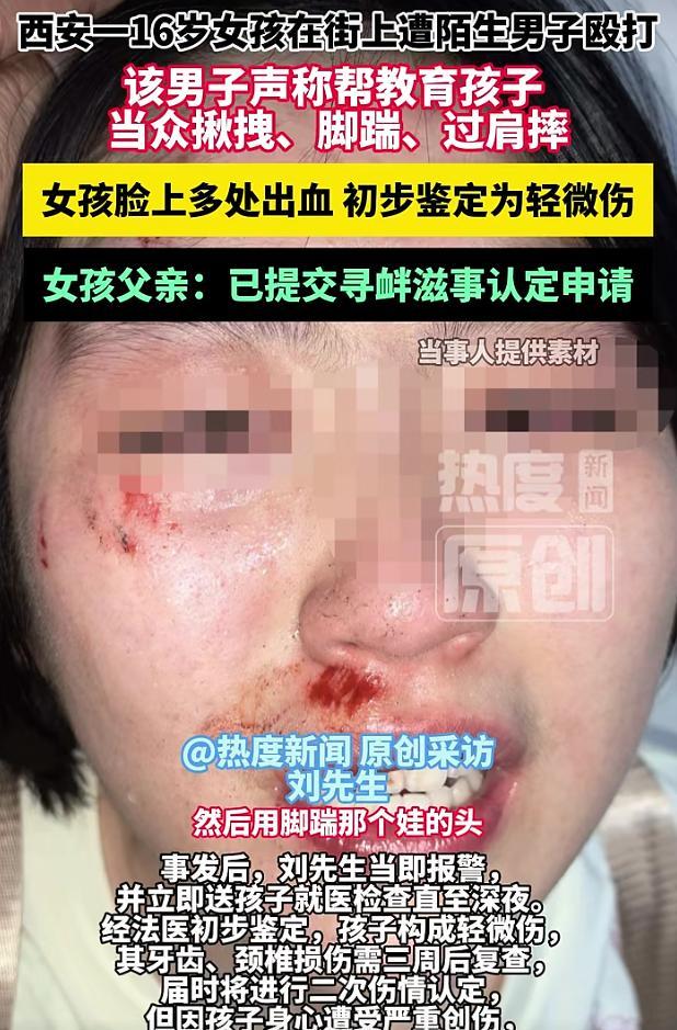 西安一女孩在街上遭陌生男子殴打 公共场所暴力事件引关注