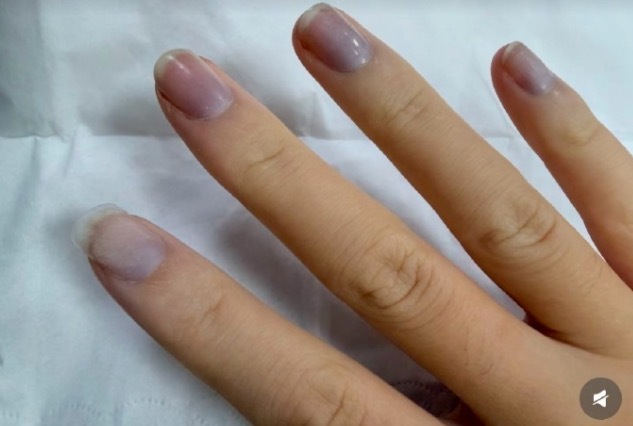 没见过气血虚成这么的 别欠妥回事