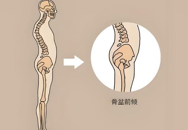 为何有些女性后腰有两个“凹点”，而有些女性却没有呢？早看早好