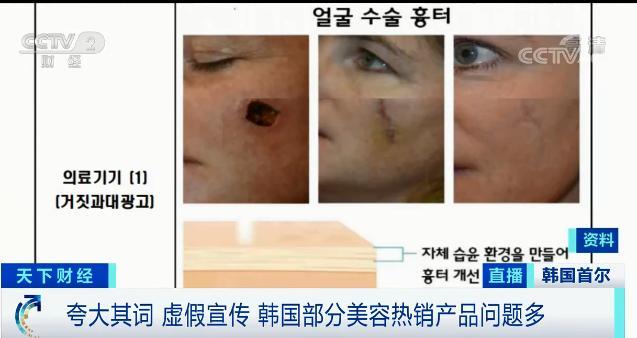 这些网红韩国爆款减肥霜疤痕贴涉虚假宣传！