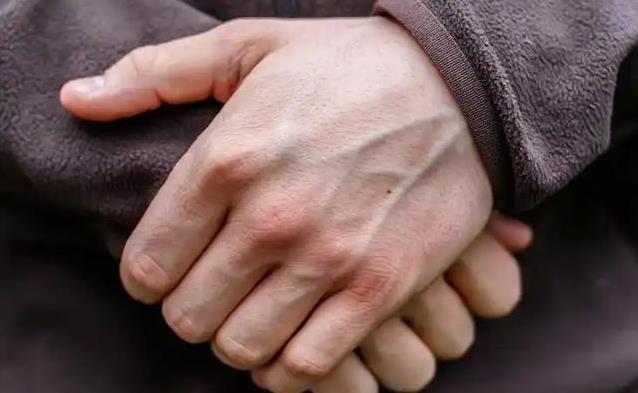 手背青筋鼓得吓人，查出血压高，3个地方青筋要当心