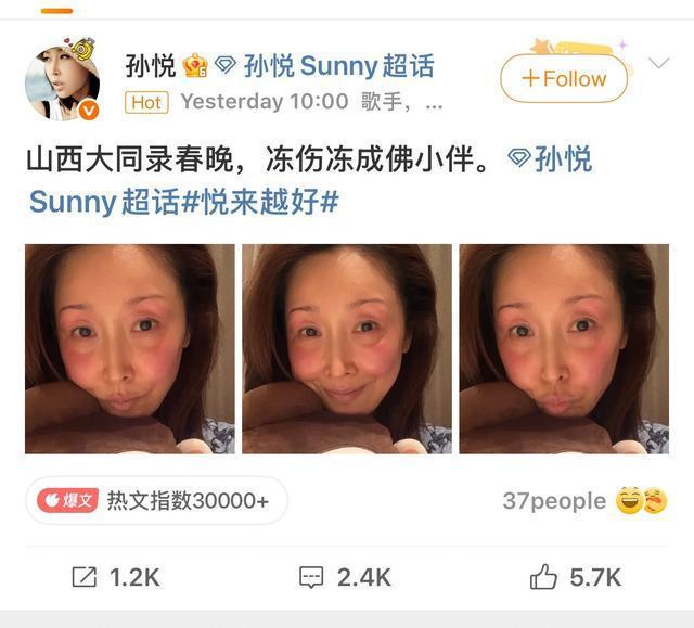 寒潮来袭警惕冻伤！专家：切勿用雪搓、火烤等方式急救