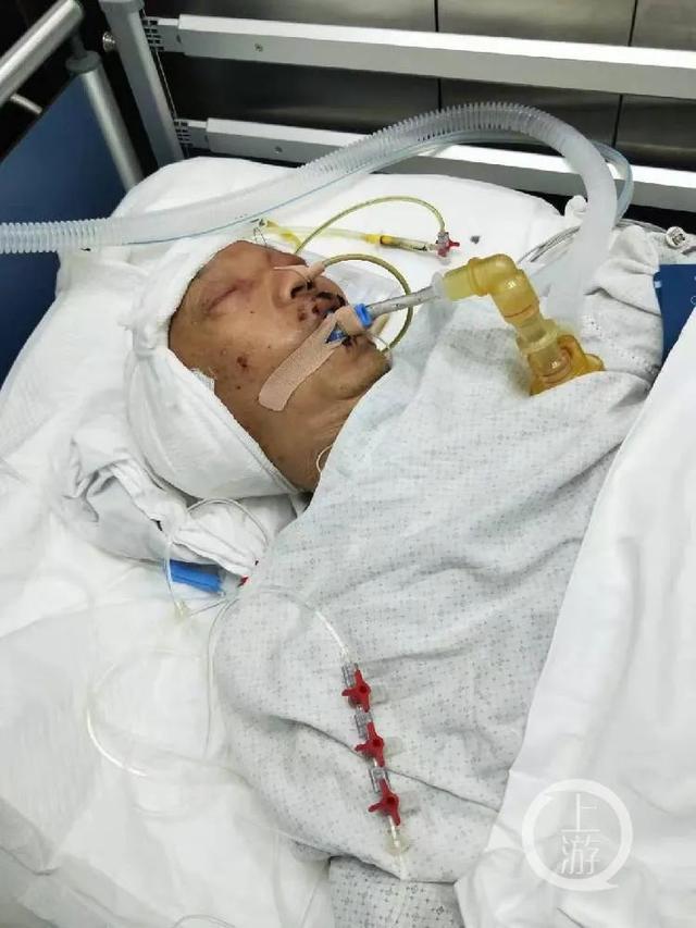 金龙泉啤酒创始人术后脑死亡 家属提出质疑 院方回应