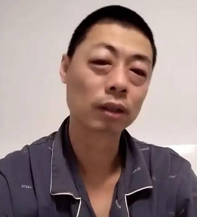 刀片株干饭株放屁株暴瘦株 你得的是啥“毒株”想要哪种