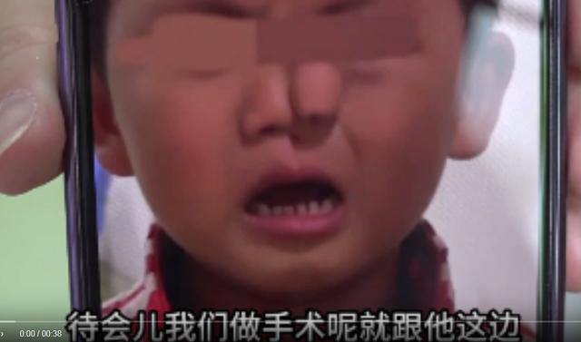 郑州一3岁男孩患象鼻病，全球仅34例且只在非洲国家发现