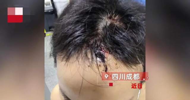成都遭家暴女子公公发声她自己摔的 网友们听到这个恢复后不淡定了！