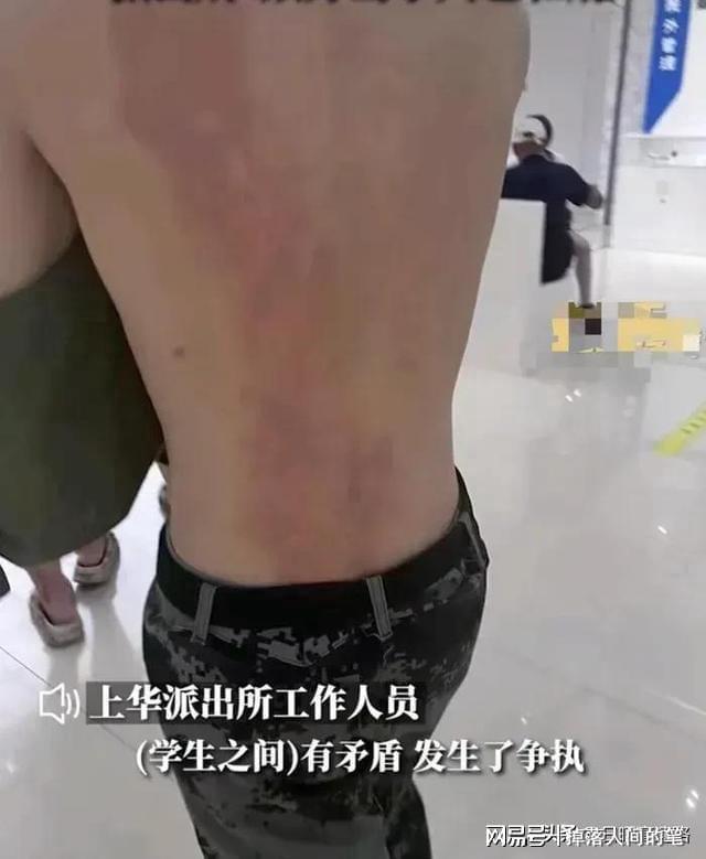 女生向男生泼热水后续，放话大不了装抑郁