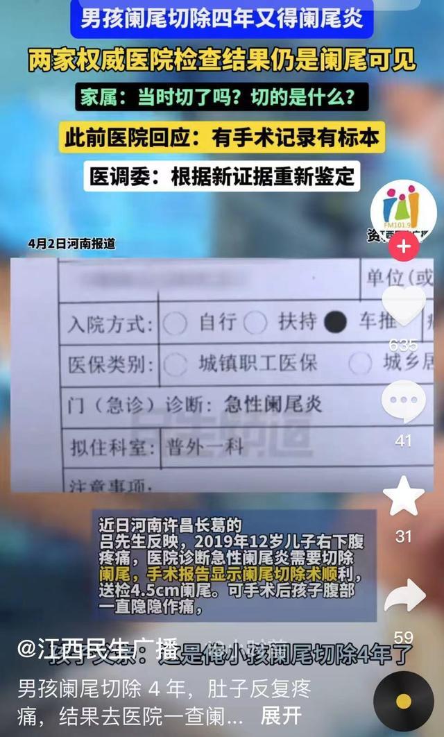 许昌男孩做阑尾切除术 5年后阑尾还在 切错了么？