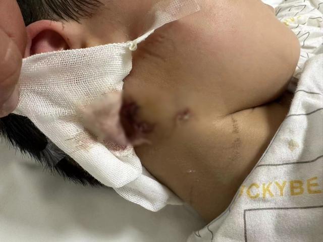 3岁男孩被狗咬伤抢救无效死亡 恶犬袭童悲剧引安全反思