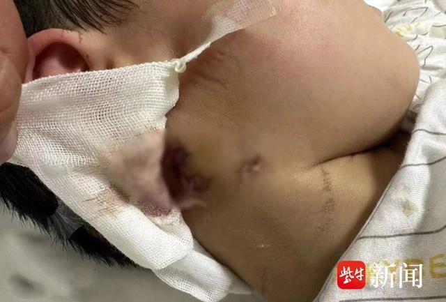 咬伤3岁男童恶犬已被打死 狗主人仍潜逃，家属求公道