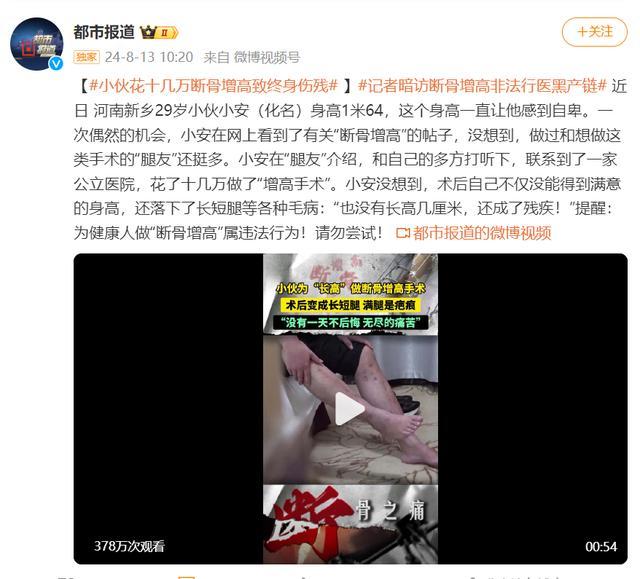 男子断骨增高致终身伤残 非法手术酿悲剧