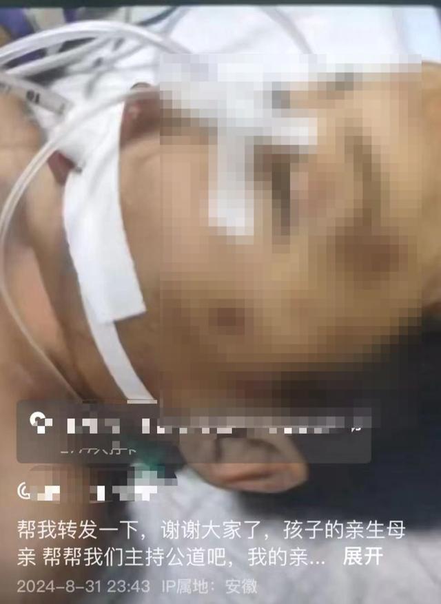 母亲发文称3岁幼童遭生父女友虐待进ICU 嫌犯被刑拘