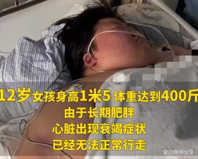 12岁女孩体重400斤无法行走