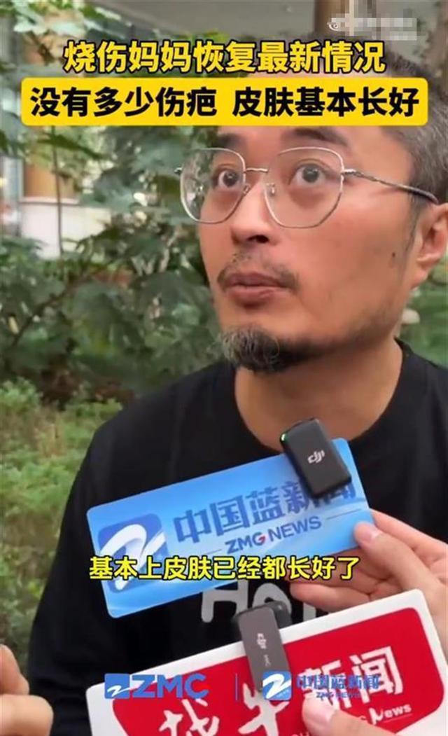 烧伤妈妈术后首次开口说话