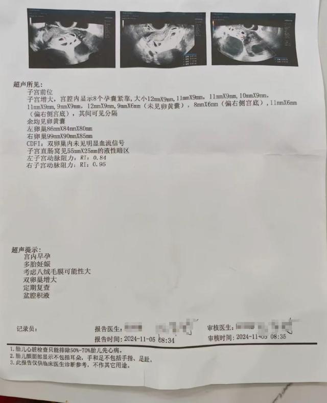 9胞胎夫妻发文称：已顺利进行第1次减胎，健康考量引关注