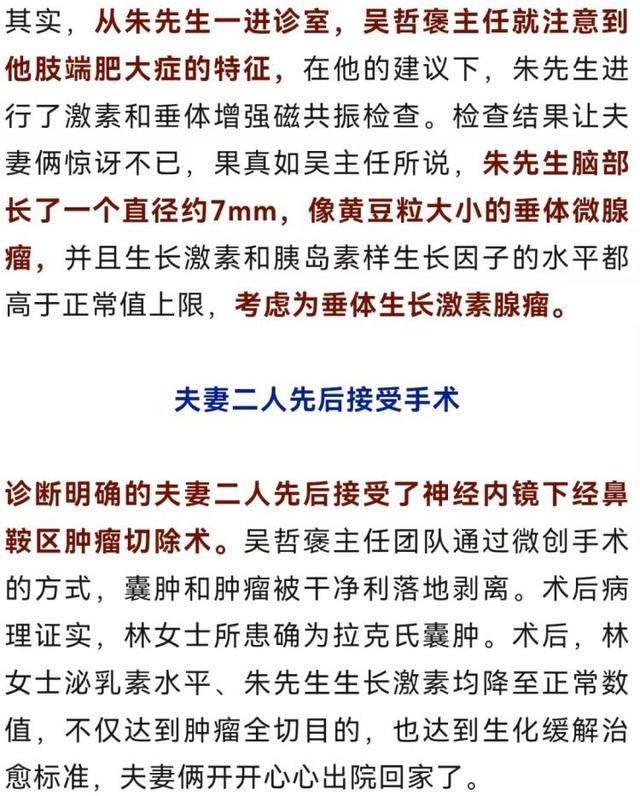 男子陪妻看“垂体瘤”，医生说：她不是，你才是！一眼被认出的这个病症必须注意